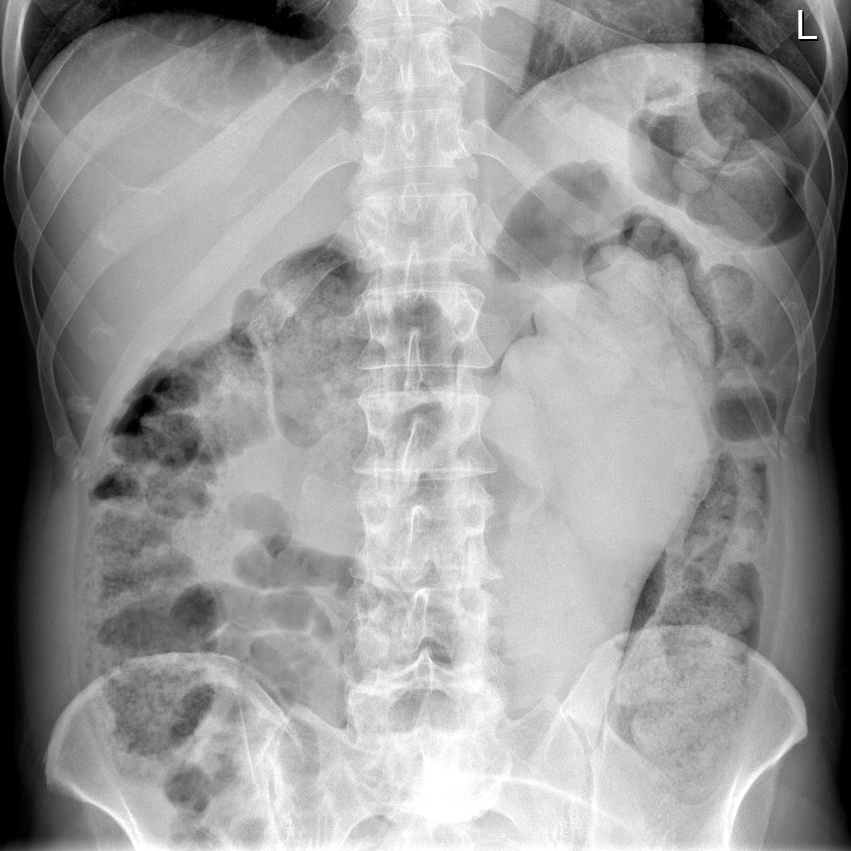 rectum-fist-dildo-x-ray-20.jpg