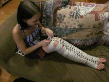  rope_leg_mummification_by_forestwolfdragon-d5hgch0.jpg thumbnail