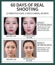  v-shape-face-device-15.webp
