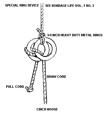 This next image describes how to construct a special ring device which is u...